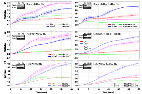 Effect of siRNA-mediated Rac1b knockdown on TGF-&#x3b2;1-induced cell motility in pancreatic epithelial cells.