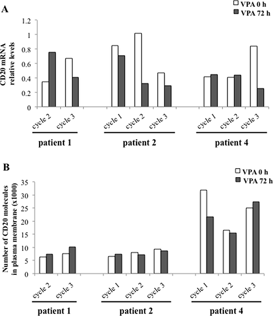 Repeated valproate-treatment in vivo does not induce expression of CD20 mRNA or surface protein in three CLL patients.