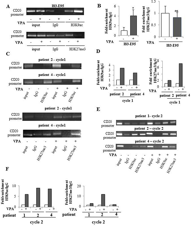 Valproate induces simultaneous H3K9ac and H3K27me3 in the CD20 promoter in CLL patients in vivo but not in the I83-E95 CLL cell line.