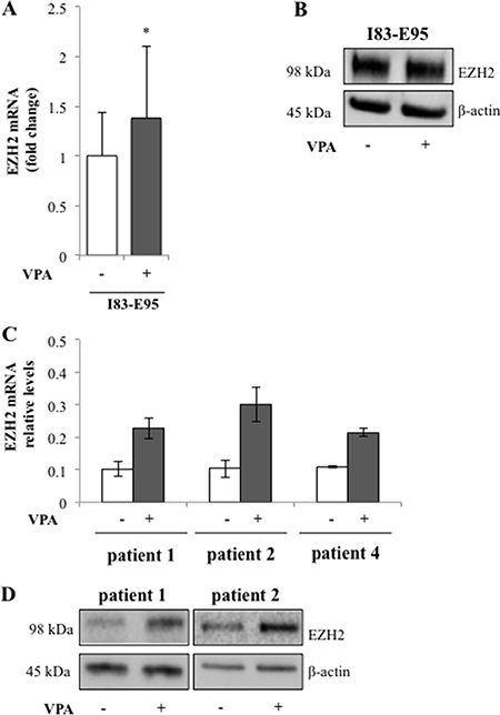 Valproate induces expression of the transcriptional repressor EZH2 in CLL patients.