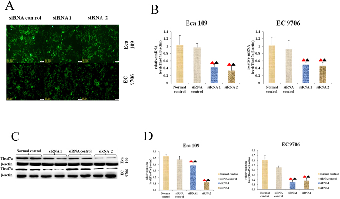 Expression of Thsd7a was knocked out with specific siRNA1 and siRNA2.