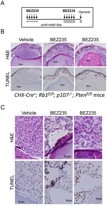 BEZ235 induces apoptosis in murine retinoblastoma cells.