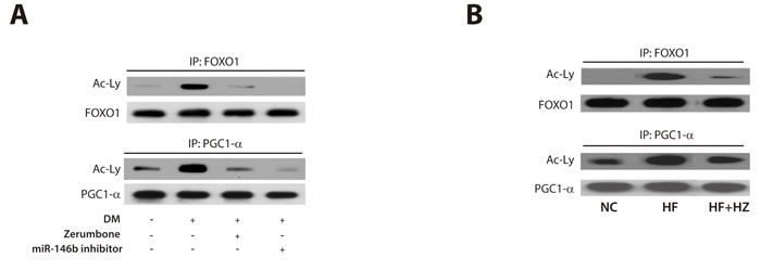 Zerumbone increased deacetylation of FOXO1 and PGC1-&#x3b1;.