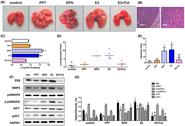 Estrogen and DPN promote lung metastasis of A549 human non-small cell lung cancer cells in vivo while Fulvestrant suppressed the metstasis.