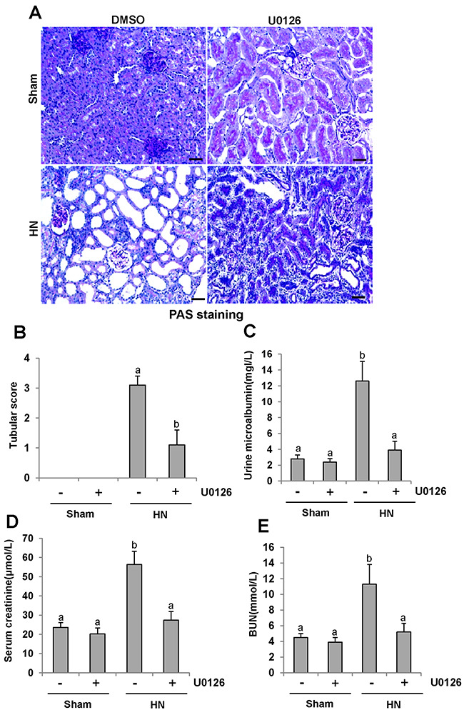 U0126 halts progression of proteinuria and improves renal function and kidney pathology in hyperuricemic rats.