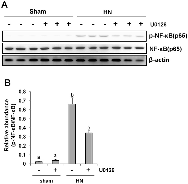 U0126 inhibits NF-&#x03BA;B pathway activation in the kidney of hyperuricemic rats.