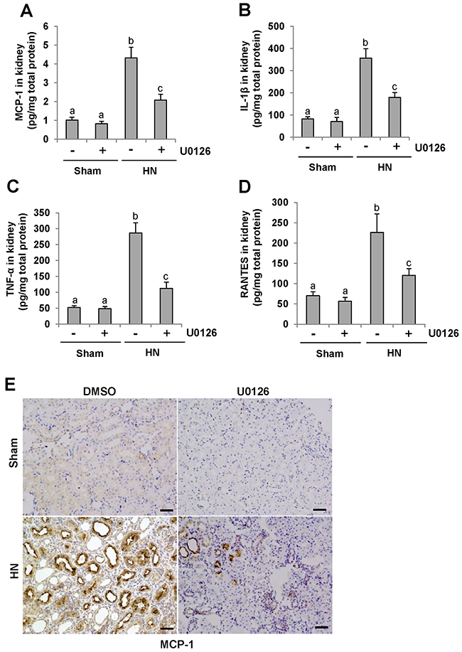 U0126 reduces the expression of MCP-1, IL-1&#x03B2;, TNF-&#x03B1; and RANTES in the kidney of hyperuricemic rats.