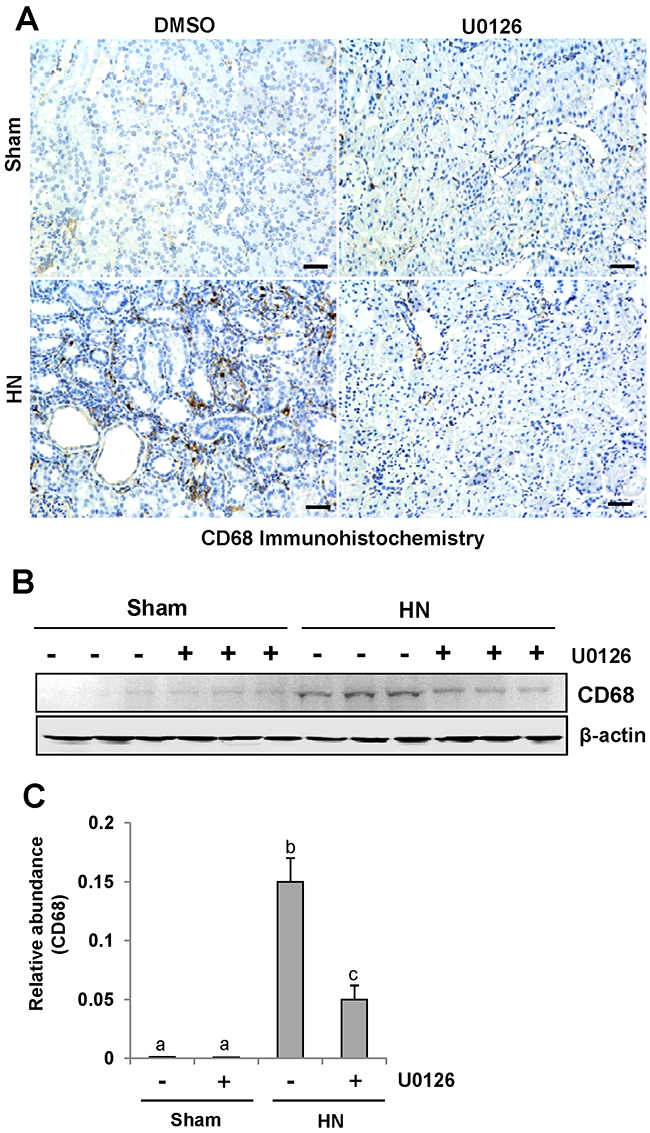 U0126 inhibits macrophage infiltration in the kidney of hyperuricemic rats.