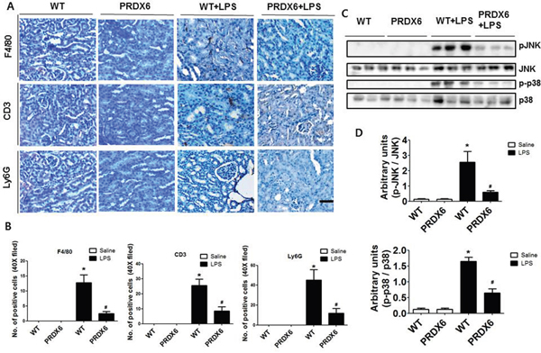 PRDX6 mice showed lower LPS-induced immune cells infiltration and activation of MAPK in the kidney than WT mice.