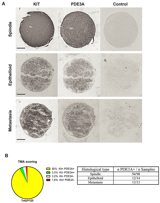 PDE3A-ir in most human GIST irrespective of the histological subtype.