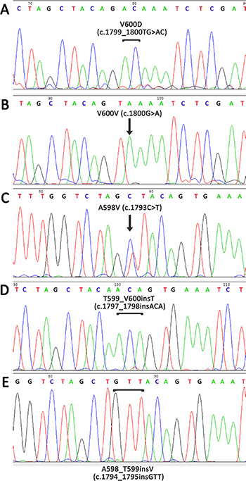 Detection of rare mutations in the BRAF gene using Sanger sequencing with preliminary enrichment with mutant allele.