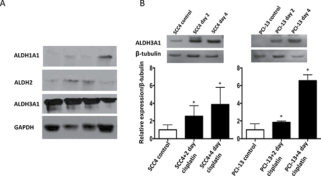 Cisplatin increases ALDH3A1 expression in HNSCC.