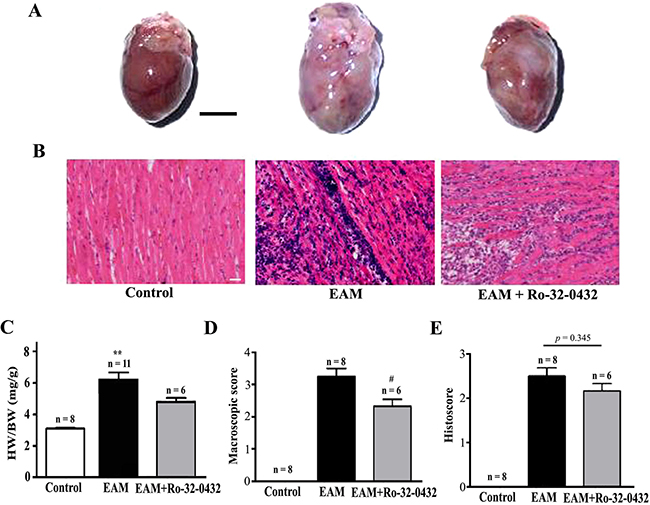 Histopathological analysis on the heart of EAM and Ro-32-0432 treated EAM rats.