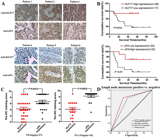 The expression of KLF17 in lung adenocarcinoma tissues was negatively correlated with the expression of uPA and was correlated with the overall survival time of patients.