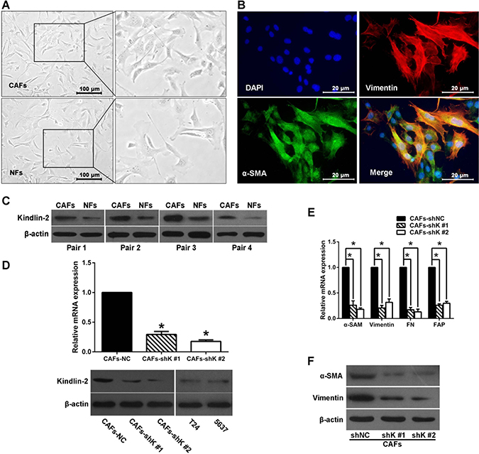 Kindlin-2 regulates fibroblast activation.