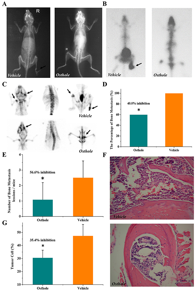 Osthole-mediated inhibition of breast cancer bone metastasis in mice.