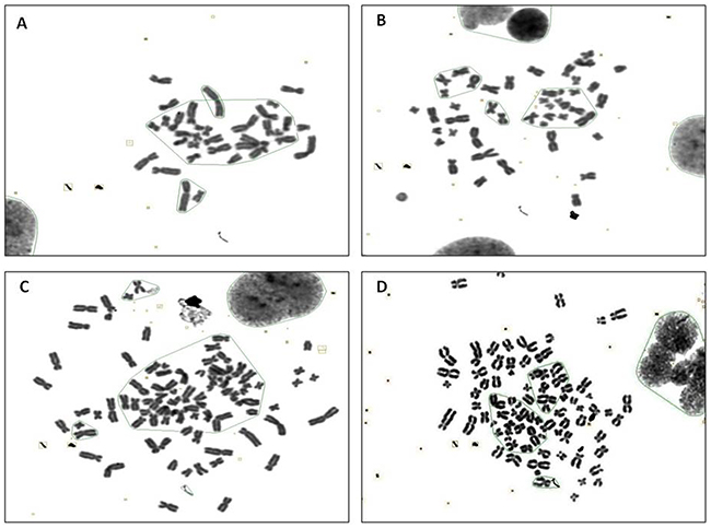 The karyotype representatives of chromosome number changes in BEAS-2B cells by G band staining at passage 30 stimulated with CTPE.