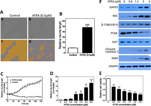 Neurite length is a quantifiable differentiation marker of BE(2)-C cells.