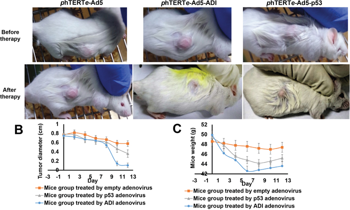 ADI adenovirus driven by phTERTe promoter successfully dissolved the tumors in mice hepatic tumor model.