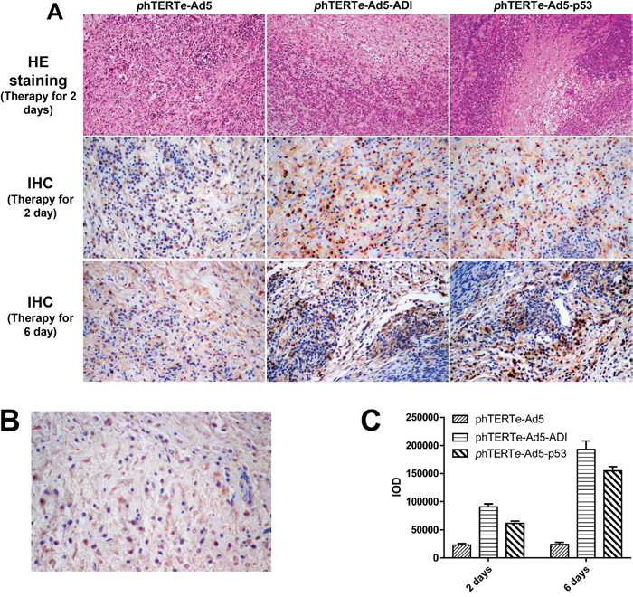 HE and IHC staining of tumor tissues from gene therapy mice.