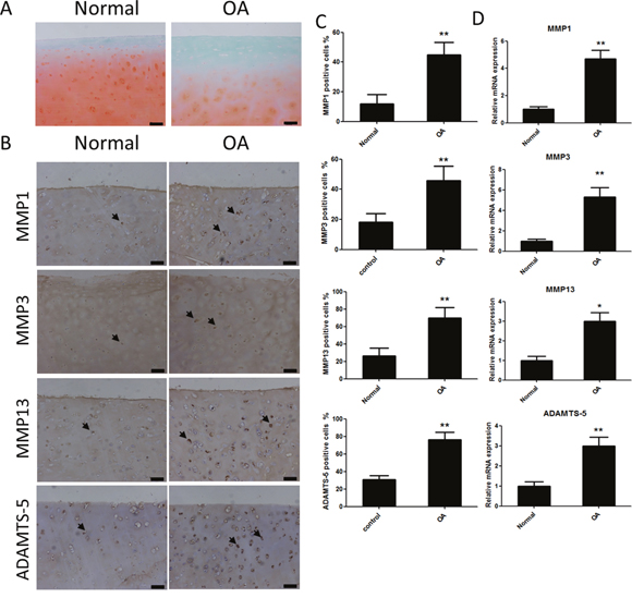 Safranin Orange staining and expression of catabolic proteases and extracellular matrix proteins in cartilage samples from human patients with or without osteoarthritis (OA).