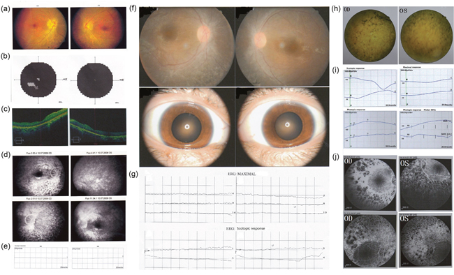 Clinical characteristics of 3 patients Patient P065.