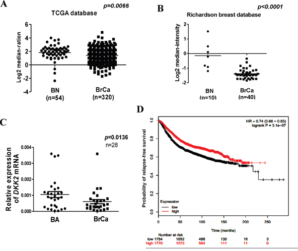 Expression and significant of DKK2 in breast carcinoma.