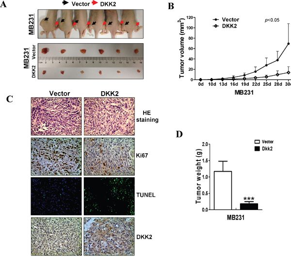 DKK2 inhibited mammary carcinoma growth in vivo.
