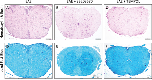 Each of the two treatments inhibits the development and progression of EAE in mice.