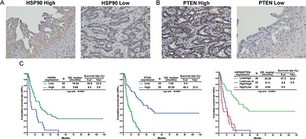 HSP90 and PTEN expression was correlated with survival in 78 patients with resectable MF-CCA.