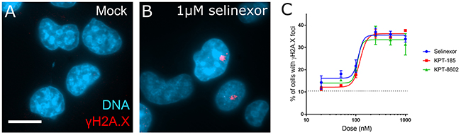 DNA damage foci formation is dose-dependent in response to SINE treatment.