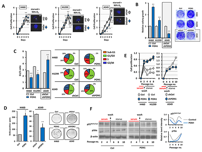 PON1 regulation impacts lung cancer cell growth and arrest programs.