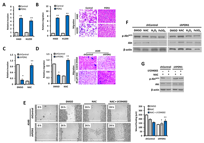 PON1 controls metastatic lung cancer cell behavior by regulating oxidative response.
