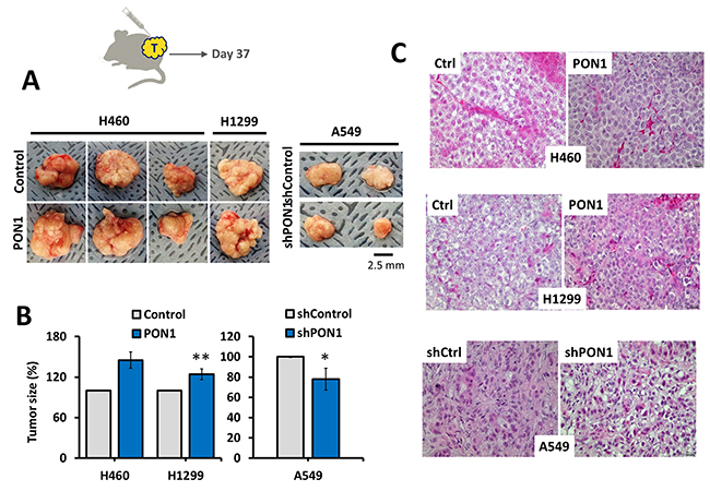 PON1 promotes tumor growth in vivo.
