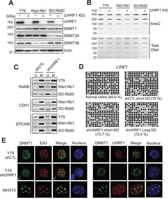 Effects of UHRF1 knockdown on DNA methylation in retinoblastoma cells.