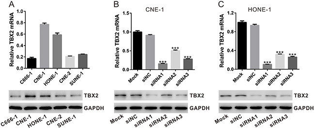 siRNA knockdown of TBX2 in NPC cells.