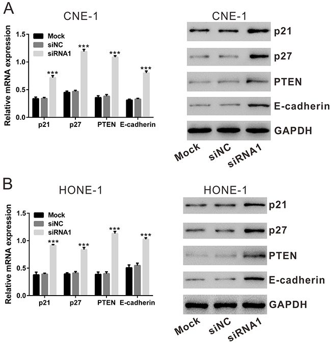 Effect of TBX2 siRNA1 on the mRNA and protein expression of p21, p27, PTEN and E-Cadherin by qRT-PCR and Western blotting assay, respectively.