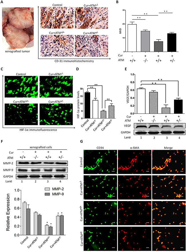 In vivo effects of CUR on HIF-1&#x03B1; expression and angiogenesis.