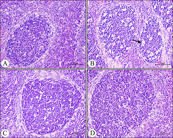 Histological structure of the diffuse lymphoid tissue and lymphatic nodules in the lamina propria of the cecal tonsil at 21 days of age under light microscopy (H.E staining).