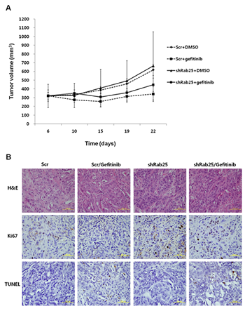 Evaluation of gefitinib response according to Rab25 expression status in a xenograft mouse model.