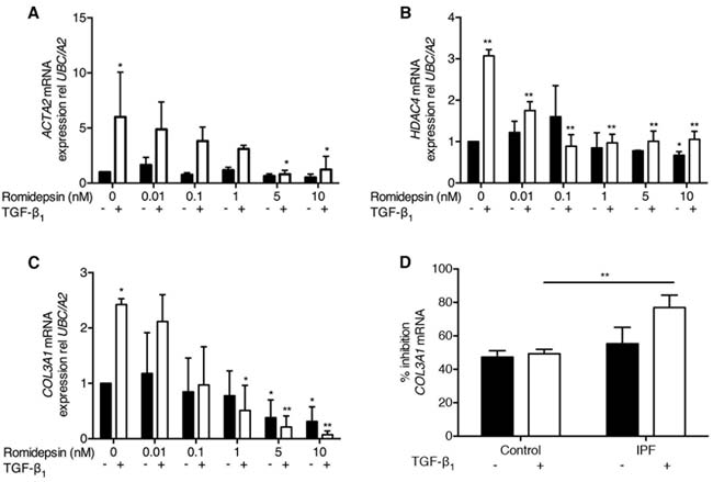 Romidepsin suppressed myofibroblast differentiation: Fibroblasts were cultured in DMEM/FBS &plusmn; TGF-&#x3b2;