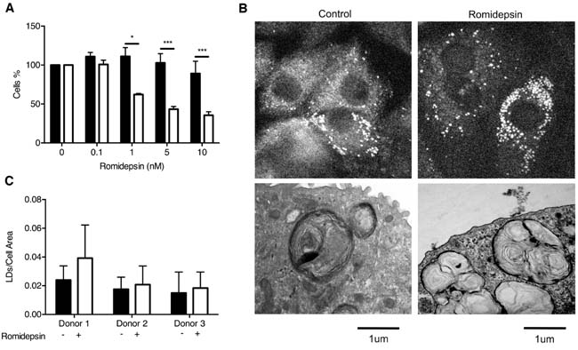 Comparison of the effect of romidepsin on alveolar type 2 cells.