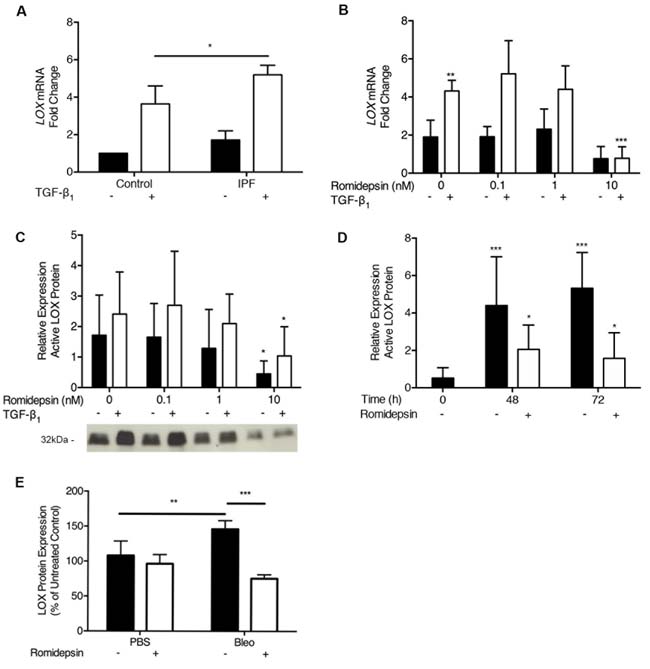 Inhibition of LOX expression by Romidepsin: IPF or normal fibroblasts were cultured in DMEM/FBS in the absence (solid bars) or presence (open bars) of TGF-&#x3b2;
