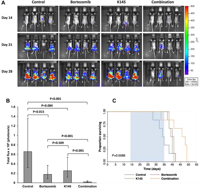 Dual bortezomib and K145 therapy shows