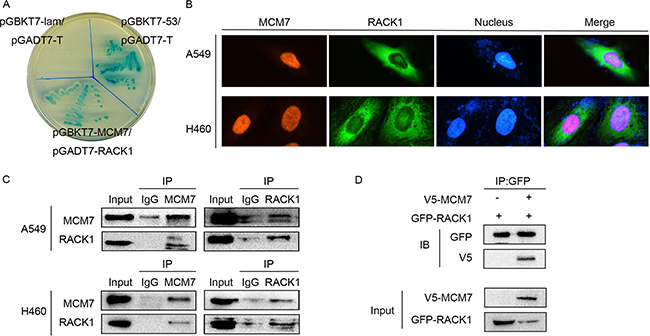 RACK1 interacts with MCM7.