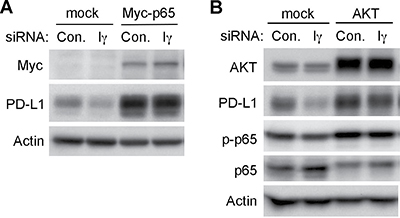 Overexpression of p65 or AKT recovered the downregulation of intrinsic PD-L1 expression caused by PIPKI&#x03B3; depletion.