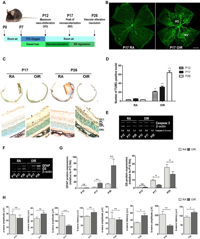 Neovascularization, neurodegeneration, glial activation and functional loss in OIR mouse retinas.