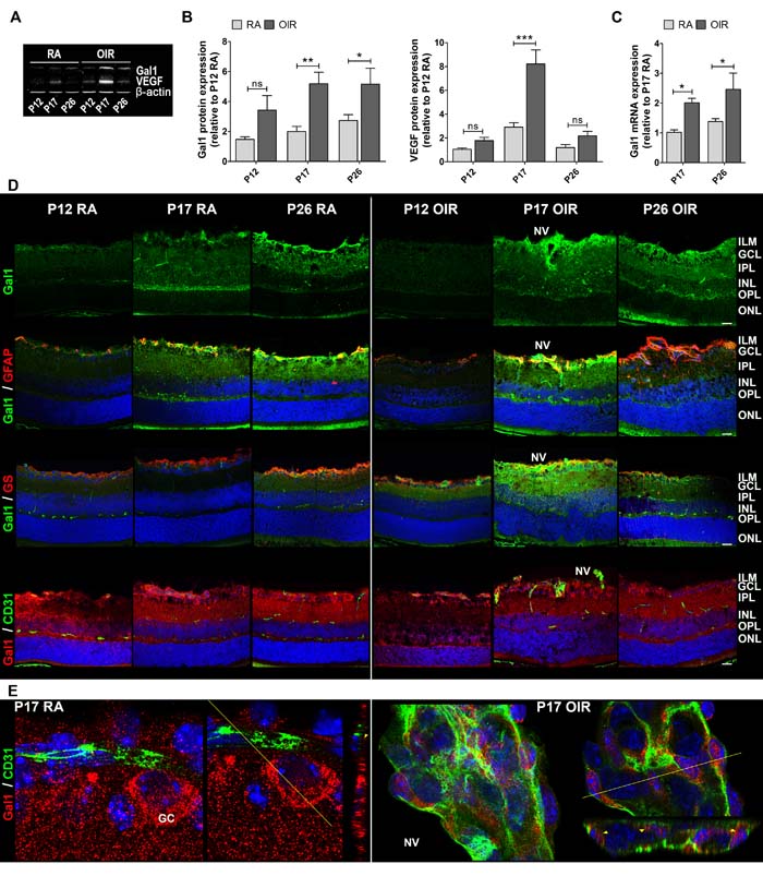 Gal1 expression and localization in RA and OIR mouse retinas.