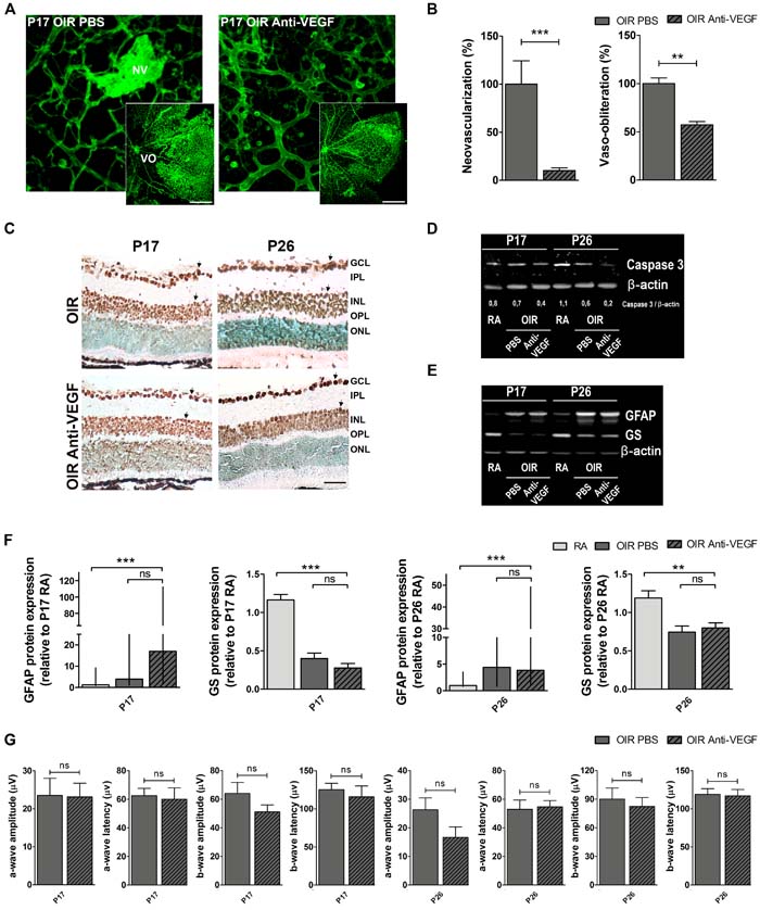 Impact of anti-VEGF treatment in the OIR mouse model.