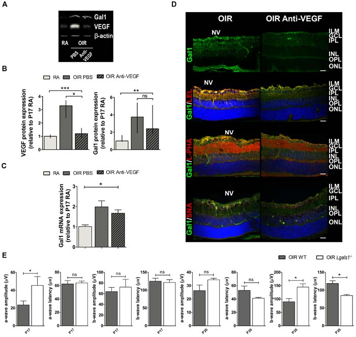Gal1 expression and function as well as the glycophenotype of mouse OIR retinas after anti-VEGF therapy.